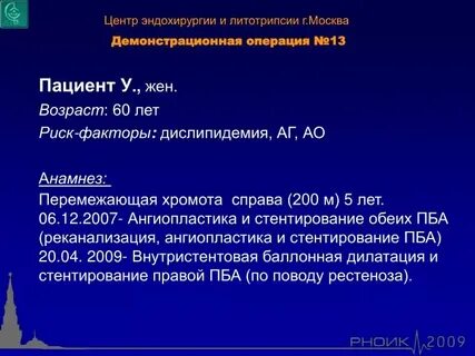 Операция 13