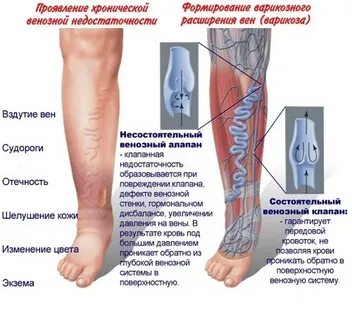 Почему теплее в ноге