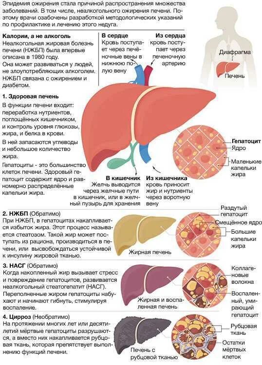 Желчный ожирение