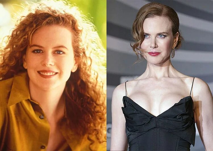 Stars before and after plastic surgery (47 pics) Plastic surgery photos, Celebri