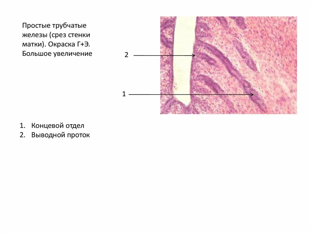 Простая неразветвленная трубчатая железа. Простая неразветвленная трубчатая железа матки. Простые трубчатые неразветвленные железы на срезе матки. Простые трубчатые железы срез стенки матки. Гистология черт возьми фанфик
