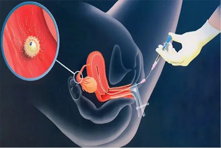 Вместо овуляции. Оплодотворение женщины. Оплодотворение женщины мужчиной. Женская яйцеклетка фото. Искусственное оплодотворение женщины.