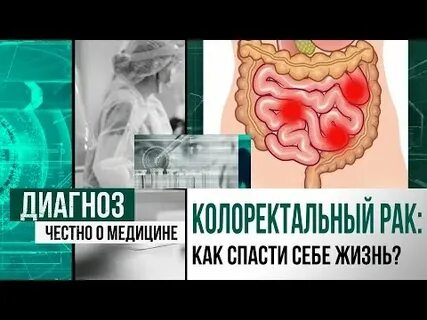 Рак перепутали с