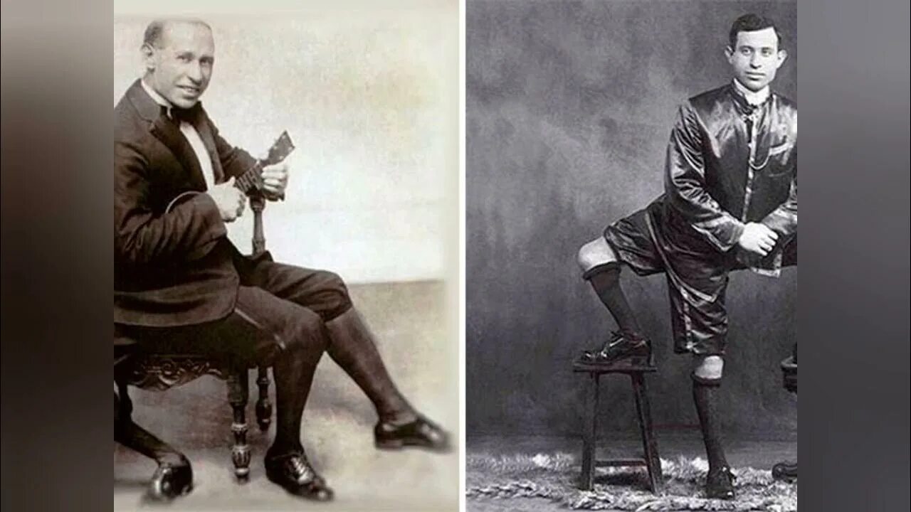 Франческо (фрэнк) лентини. Трехногий герой 1. Франческо (фрэнк) лентини. Франческо лентини в цирке. Трехногий франческо лентини.