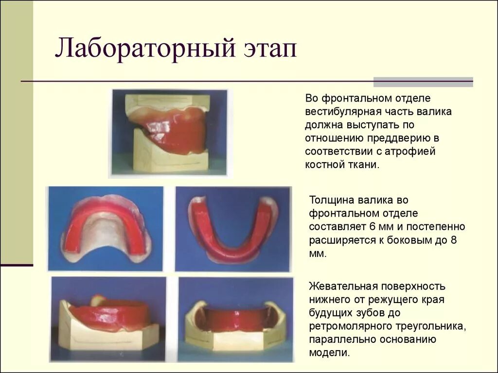 Клинико лабораторные этапы пластиночных протезов. Клинико лабораторные этапы изготовления протезов. Этапы изготовления частичного съемного пластинчатого протеза. Иммедиат протезы клинико лабораторные этапы. Прикусные валики клинико-лабораторные этапы.