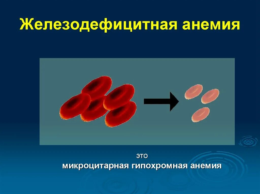 Анемия следствия. Железнодефецитная Анимия. Патогенез железодефицитной анемии. Железодефицитная анемия этиология. Этиология жда.