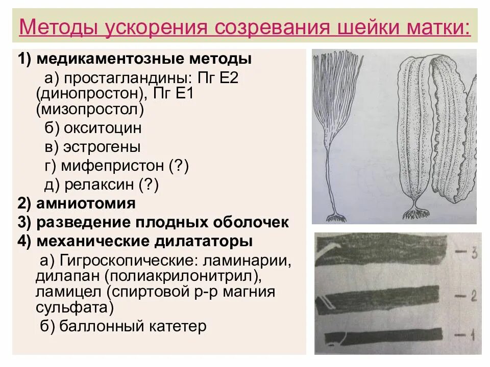 Палочки ламинарии. Палочки ламинарии для стимуляции. Ламинарии для стимуляции родовой деятельности. Ламинария палочки гинекологические. Катетер перед родами для раскрытия шейки матки