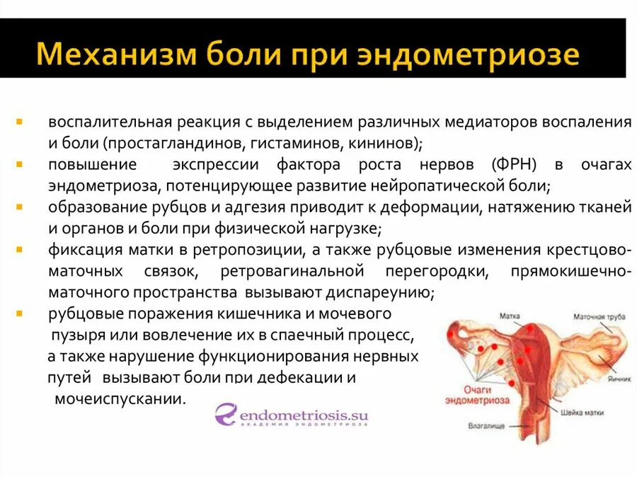 Болезненный половой акт. Клинические проявления эндометриоза. Симптомы боли при эндометриозе. Боли в пояснице при эндометриозе.