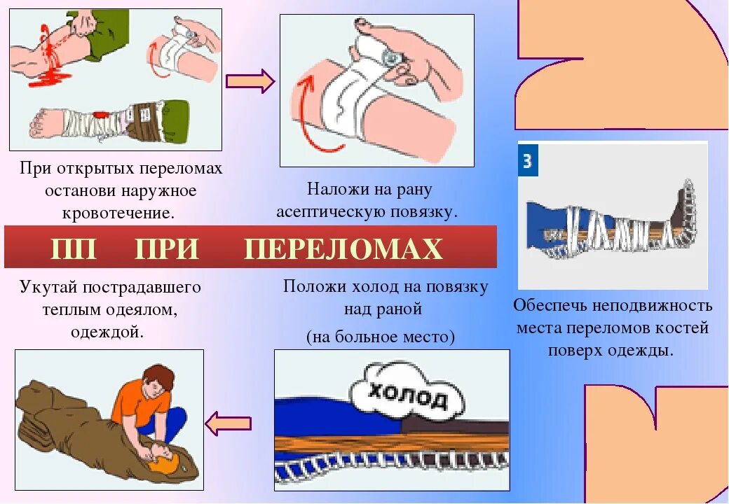 Последовательность при открытом переломе тест. Первая медицинская доврачебная помощь при открытом переломе. Алгоритм оказания первой помощи переломы конечностей. ПМП при открытом переломе. Первая помощи при открытых переломаха.