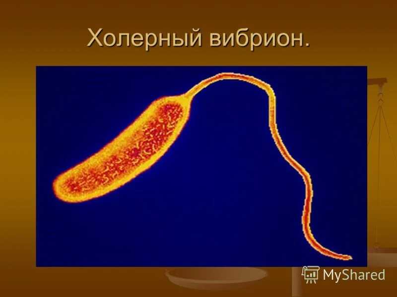 Vibrio cholerae микроскопия. вибрионы возбудитель холерный вибрион. холерный вибрион это бактерия. холерный вибрион возбудитель холеры. холера возбудитель бактерия.