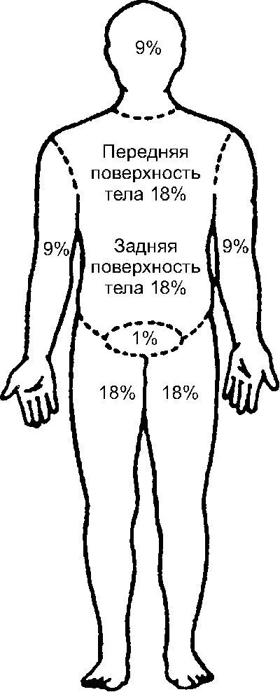 Правило 9 почему. Метод уоллеса правило девяток. площадь поражения передней поверхности туловища составляет ___ %. метод девяток при ожогах. определение площади ожоговой поверхности по правилу девяток.