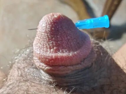 My first post...a needle in the head of the penis. 