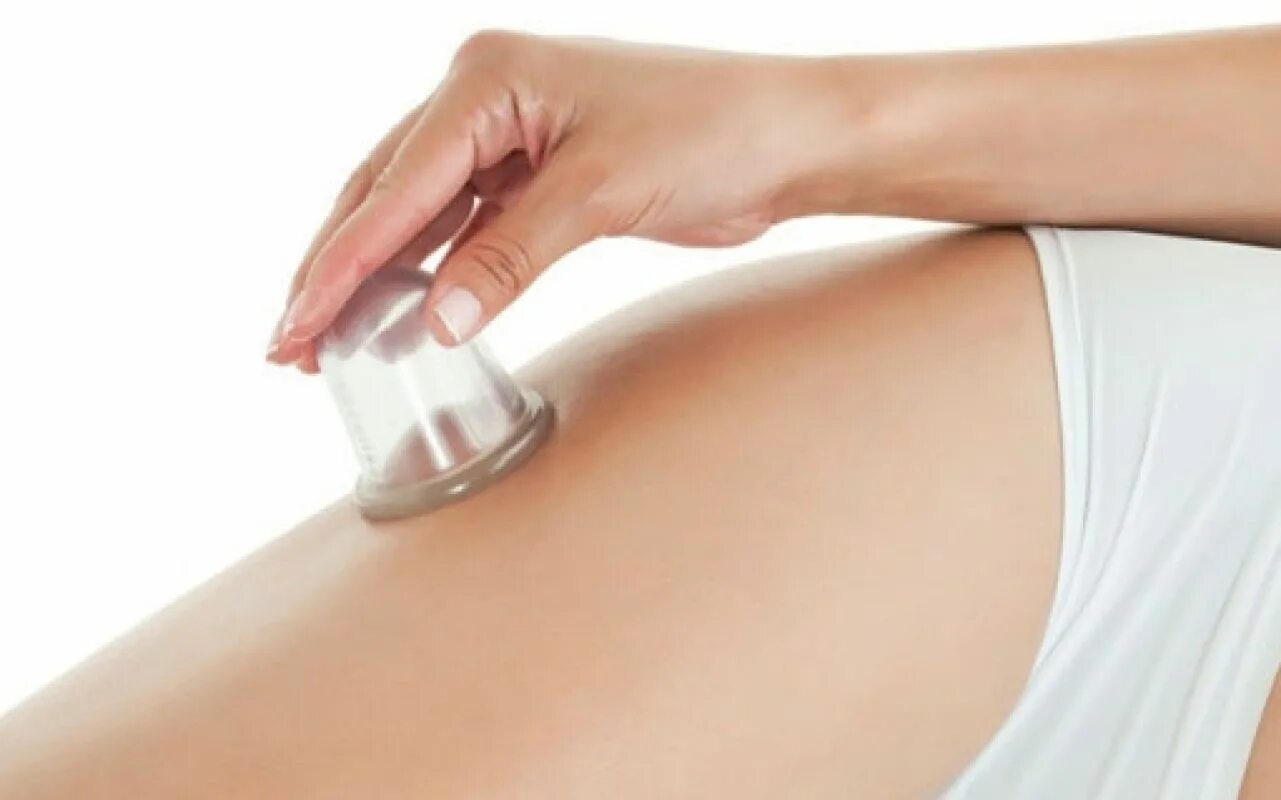 Баночный массаж от целлюлита. Баночный массаж от целлюлита техника. Вакуумно баночный массаж. Вакуумный антицеллюлитный массаж. Гиалуроновый гель для баночного массажа.