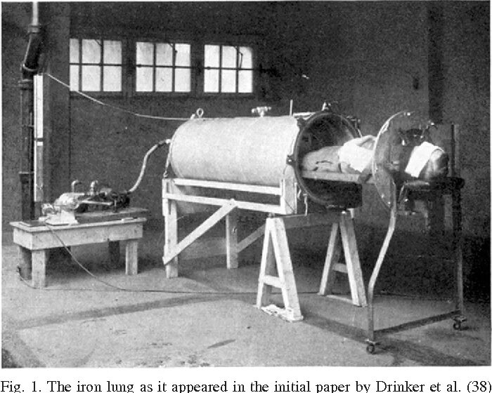 Человек в железном легком история. Первый аппарат ИВЛ В мире. Аппарат искусственного дыхания 1927. Аппарат искусственного дыхания железные легкие.