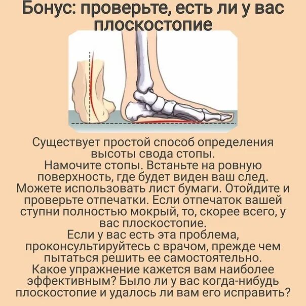 Свод стопы лечение. Высота свода стопы. продольный свод стопы. угол свода стопы.