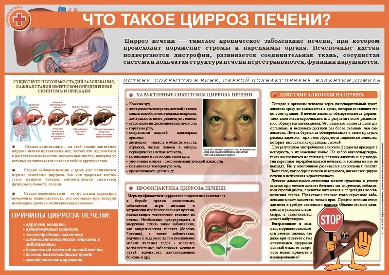 Рекомендации по лечению циррозов