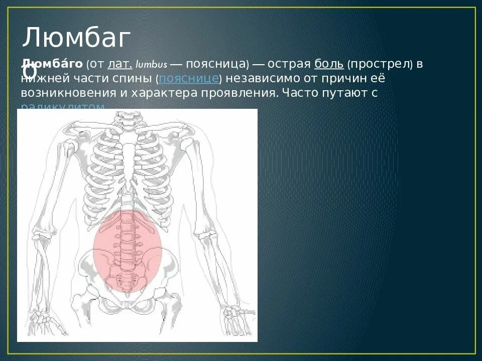 Прострелы в пояснице причины. Люмбаго. Люмбаго поясничный прострел. Люмбаго симптомы.