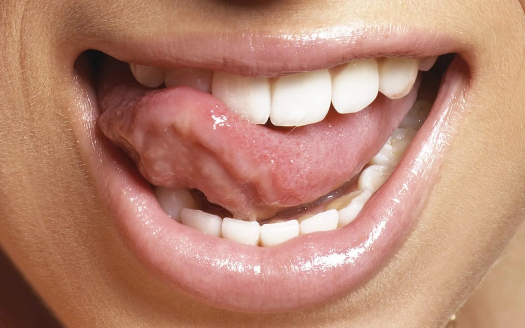 Красивый рот с языком. Артикуляционное упражнение окошко. Человек рот язык под. Человек рот язык под. Упражнение чашечка.