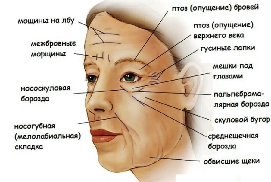 Под лицо что означает. Височные морщины. Гравитационные морщины. Схема морщин на лице. Название морщин на лице схема.