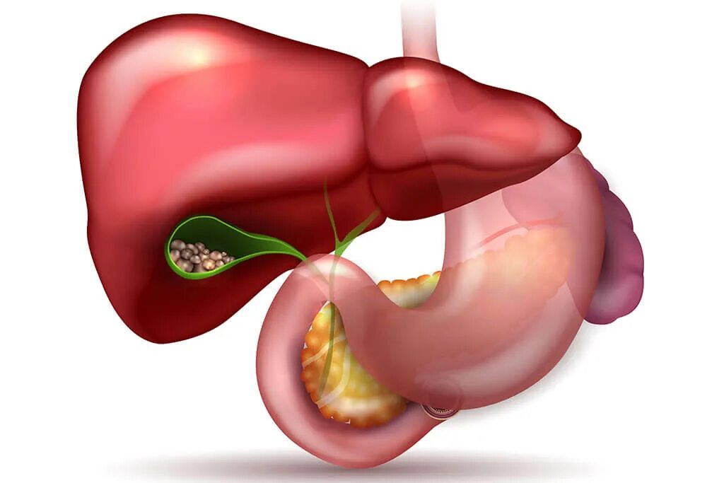 Органы гепатобилиарной системы. Заболевания гепатобилиарной зоны. Опухоли гепатопанкреатобилиарной зоны. Гепатобилиарная анатомия. Холецистит камень в желчном пузыре