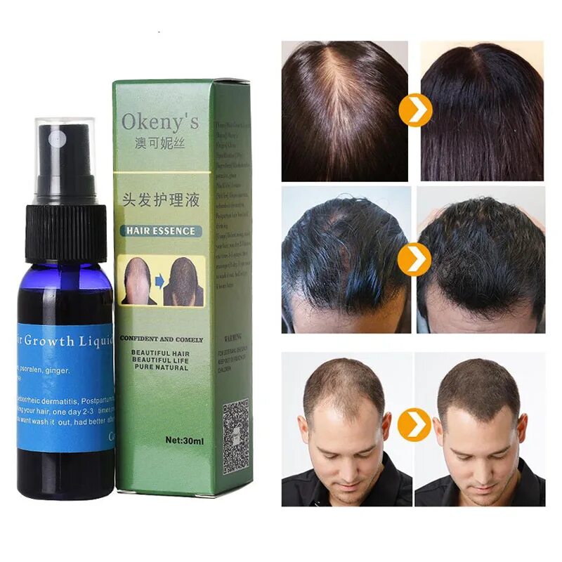 Для роста новых волос. Hair growth , Хаир спрей. Hair growth спрэй для роста волос. Алопеция спрей для роста волос. Средство против облысения для мужчин.