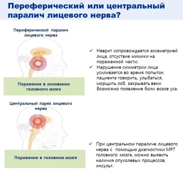 Центральный и периферический парез лицевого нерва. Центральное и периферическое поражение лицевого нерва. Центральный парез и периферический парез лицевого. При периферическом парезе лицевого нерва.