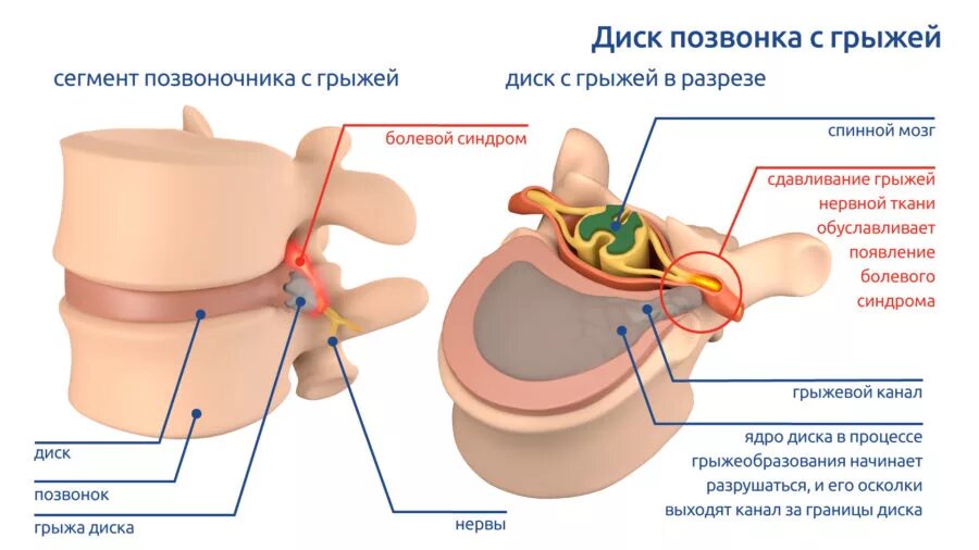 Межпозвонковый сегмент