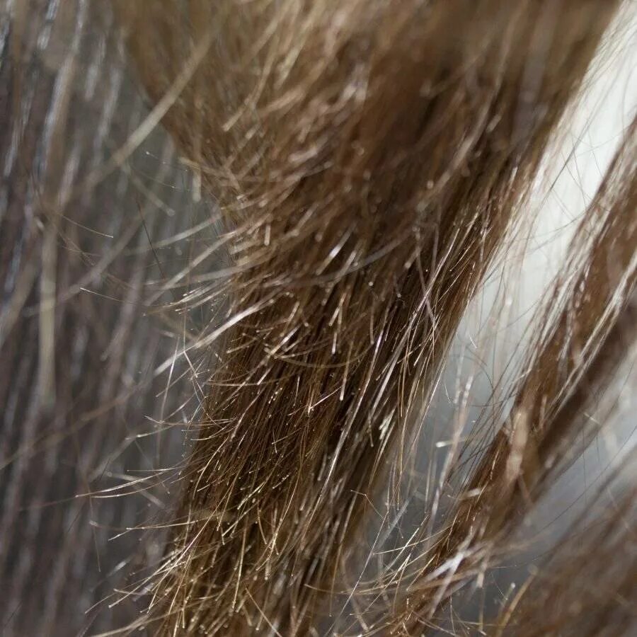 Волосы сильно повреждены. Секущиеся волосы. Секущиеся концы. Посеченные кончики. Сеченые кончики волос.