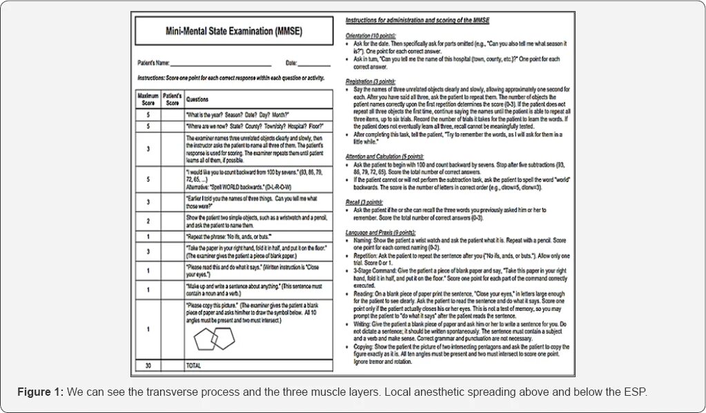 Психического статуса (Mini-Mental State examination, MMSE. Оценка психического статуса (Mini Mental State examination – MMSE). Шкала когнитивных нарушений MMSE. MMSE тест на деменцию. Шкала психического статуса