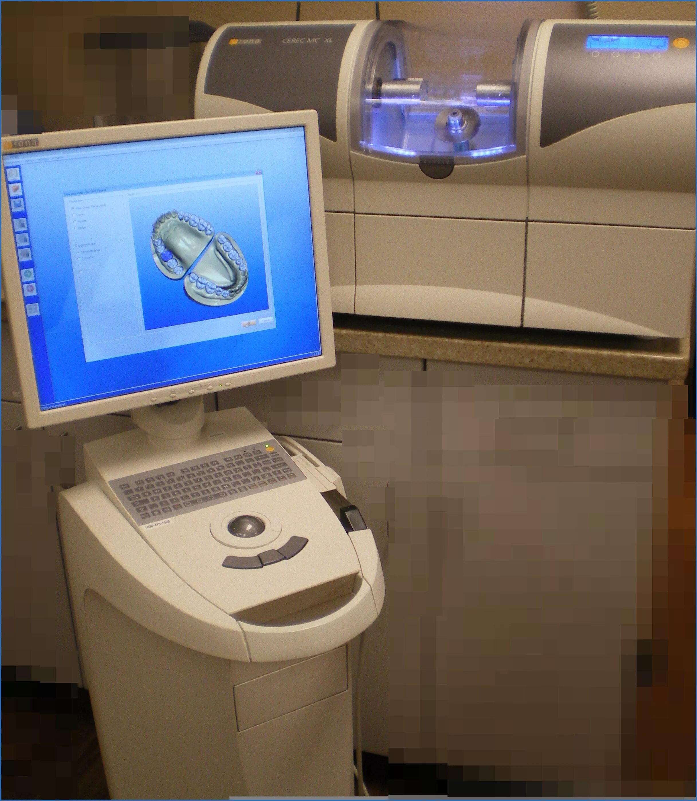 Cad cam системы. Модуль для сканирования cad/cam системы. cad cam системы в стоматологии. cerec 1985. «cad/cam система лаболаторная.