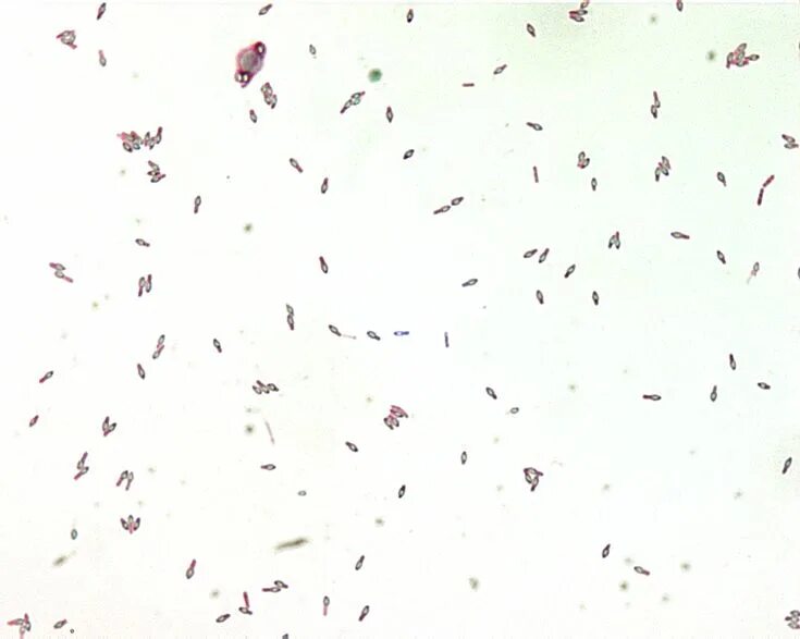 Lachnobacterium spp