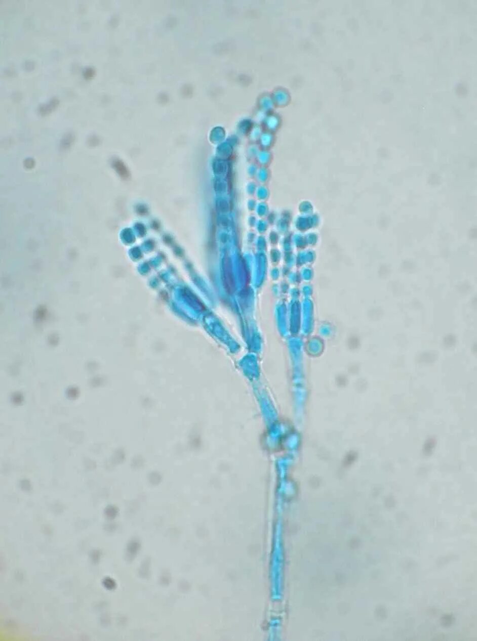 Пеницилл под микроскопом. Penicillium crustaceum. пеницилл микроскоп. плесневый гриб пеницилл. морфология penicillium candidum.