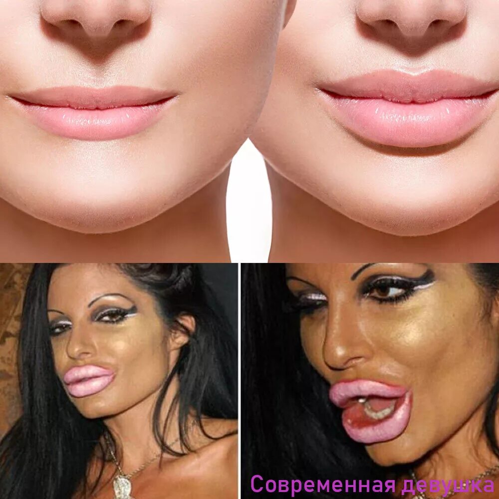 Зачем девушки делают губы. Зачем девушки делают губы