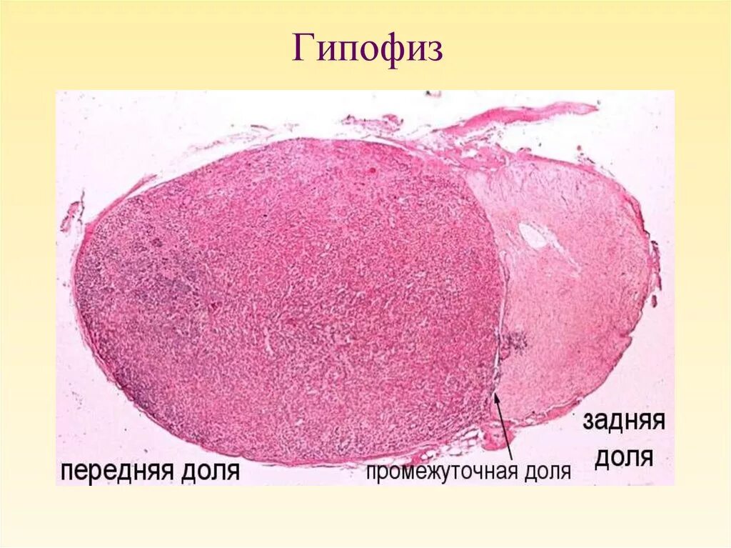 Нейрогипофиз гистология. Гипофиз гистология маллори. гипофиз под микроскопом гистология. гипофиз по маллори препарат гистология. аденогипофиз человека гистология препарат.