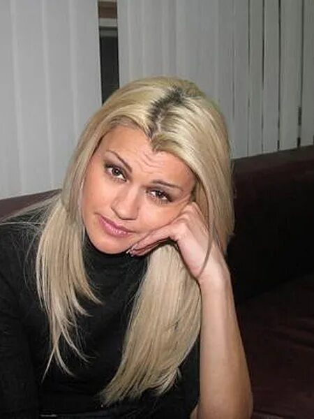 Ирина круг до и после пластики фото Ирина круг пластика лица до и после фото