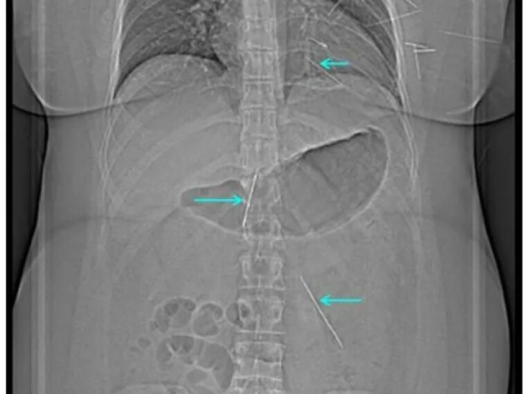 Вышивка иголкой и ниткой. Может ли иголка дойти до сердца. Может ли иголка дойти до сердца. Может ли иголка дойти до сердца. Стих про иголку с ниткой.