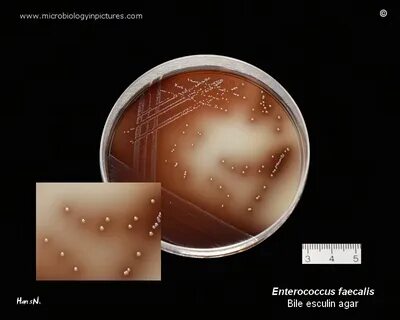 Enterococcus faecalis
