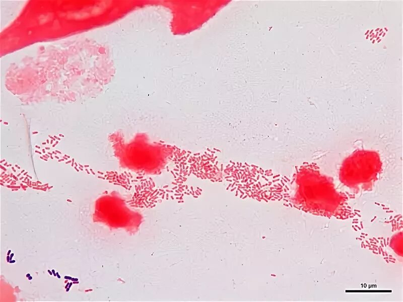 Haemophilus в мазке у мужчин. Haemophilus influaenzae микроскоп. Гемофилус инфлюэнце в мазке в норме.