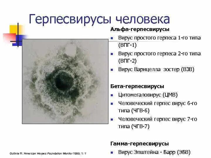 Вирус герпеса презентация. Вирус герпеса презентация. Герпес вирусы иммунитет. Герпес вирусы иммунитет. Герпес вирусы иммунитет.