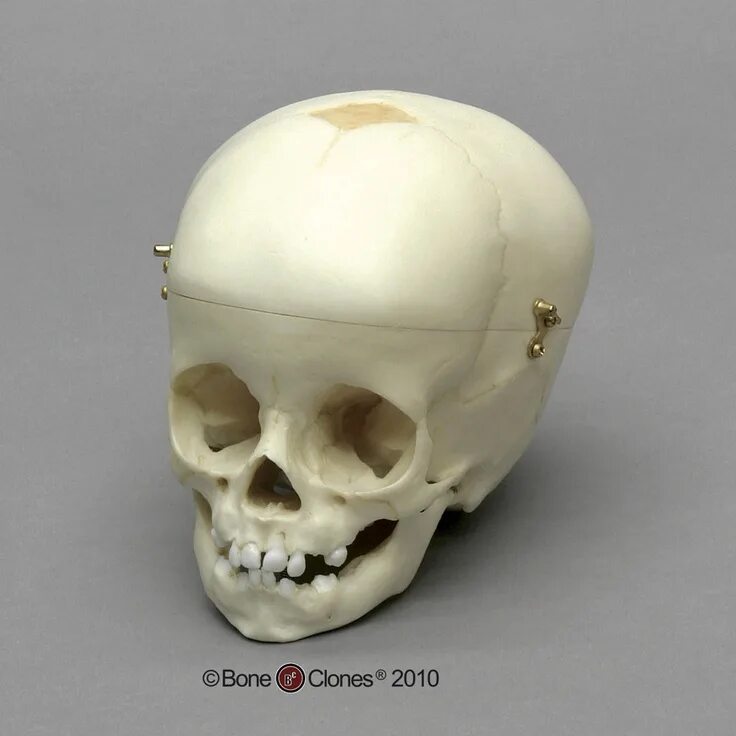 Череп макушка. Череп макушка. Череп макушка. Череп макушка. Затылочная кость кость черепа.