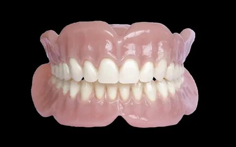 Solvay Partial Denture