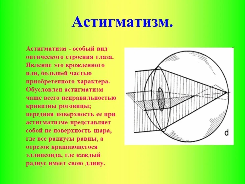 Сфера цилиндр зрение. Сфера цилиндр зрение. Ось цилиндра это в оптике. Сфера цилиндр зрение. Астигматизм глаз.