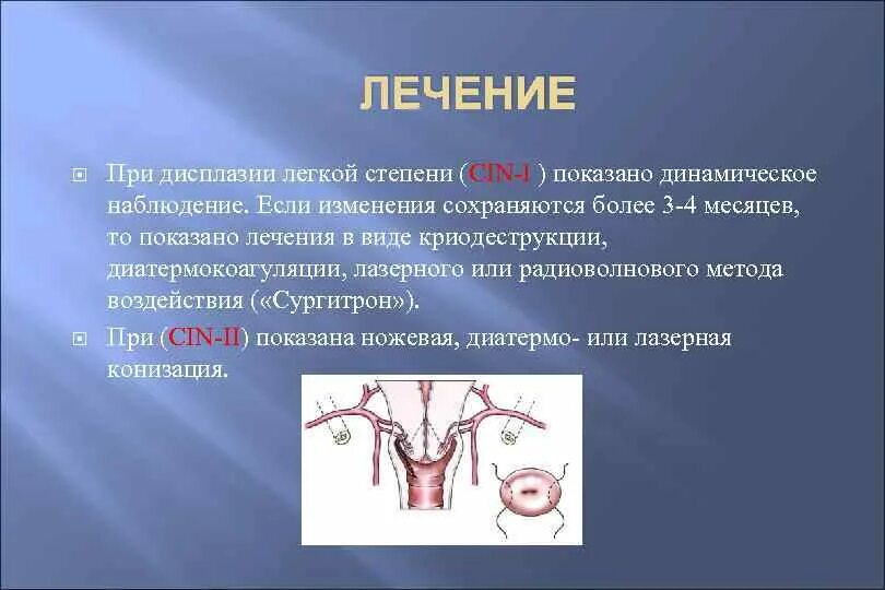 Умеренная дисплазия шейки матки что это. Дисплазия шейки матки 2 степени. Гистологическая классификация дисплазий шейки матки. Лекарство при дисплазии матки. Методы исследования дисплазии шейки матки.