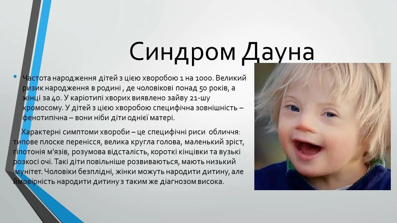 Синдром Дауна. Синдром Дауна мкб 10 у детей. Синдром Дауна код по мкб. Фенотип ребенка с синдромом дауна