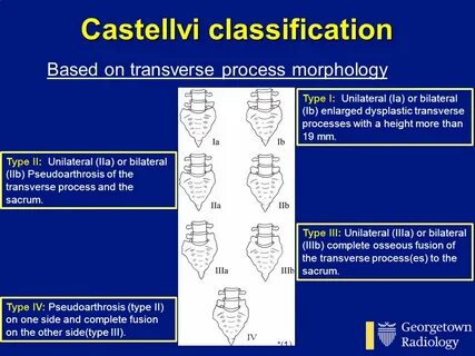 Castellvi