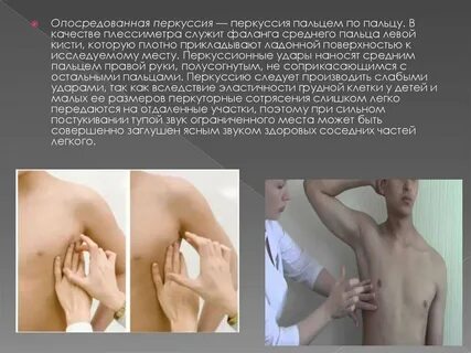 Перкуссия что это
