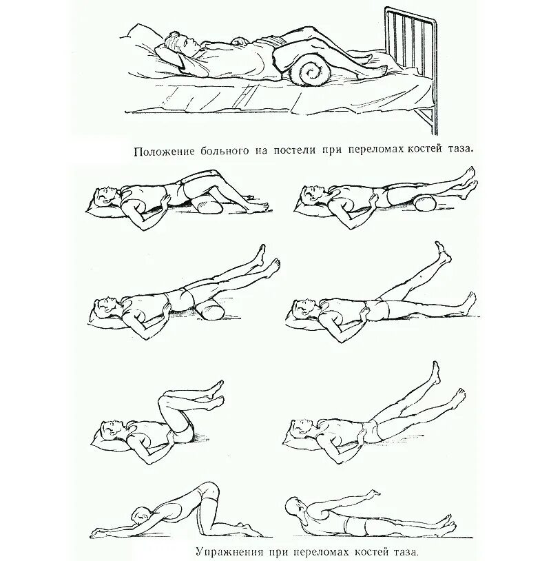Перелом бедра восстановление после операции. Лечебная физкультура после перелома лонной кости таза. Лечебная физкультура при переломе костей таза. ЛФК по 2 комплекс при компрессионном переломе позвоночника. Лечебная гимнастика после перелома костей таза.