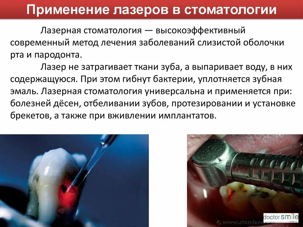 Лазерное излучение в стоматологии. Лазеры применяемые в стоматологии. Аргоновый лазер в стоматологии.