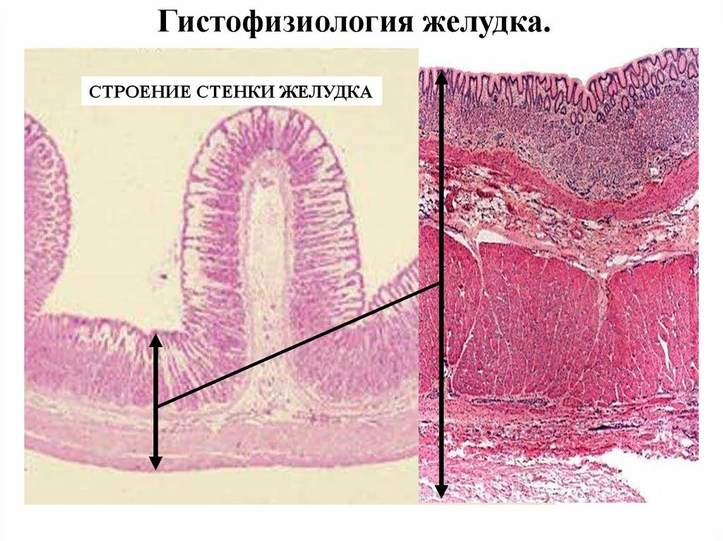 Клетки слизистой полости рта. Строение стенки желудка. Строение стенок желудк. Желудок строение стенки желудка. Общий план строения стенки желудка.