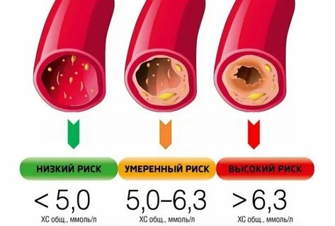 Большой холестерин причины